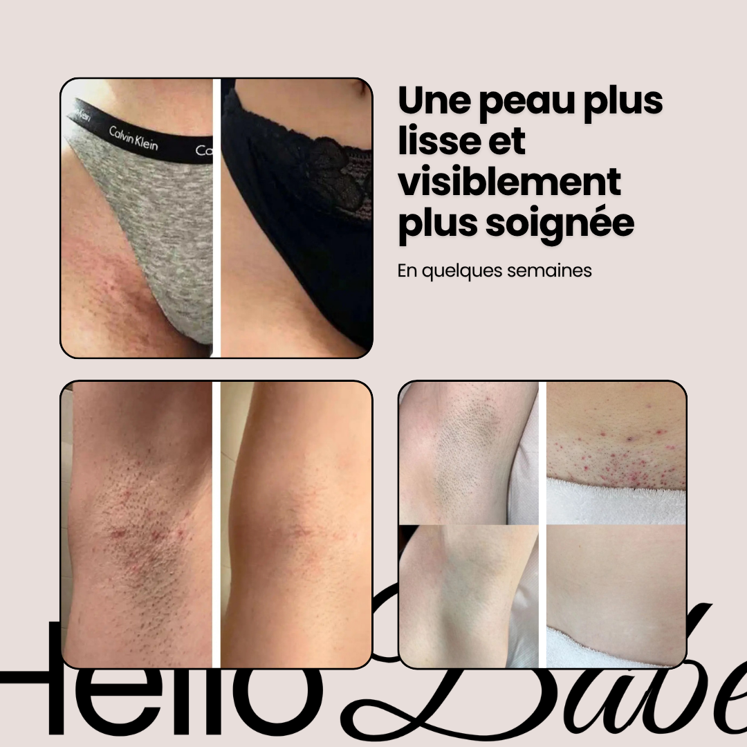 HelloBabe IPL Pro · Épilateur à lumière pulsée corps et visage
